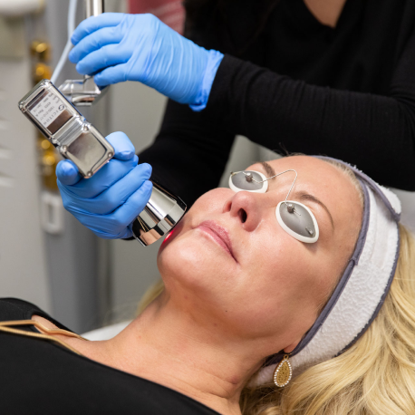 Sciton® ProFractional