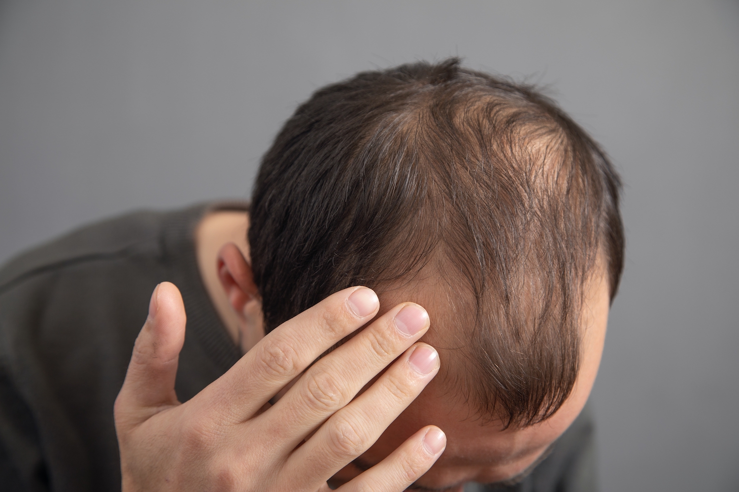 Medicatie tegen haarverlies